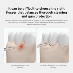 Xiaomi Water Flosser 2-90 Day Battery Life, 3 Cleaning Modes, 200 ml Water Tank, IPX7, Deep Cleaning, USB Charging, Includes Standard & Ortho Nozzle