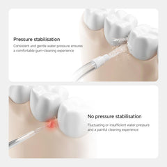 Xiaomi Water Flosser 2-90 Day Battery Life, 3 Cleaning Modes, 200 ml Water Tank, IPX7, Deep Cleaning, USB Charging, Includes Standard & Ortho Nozzle
